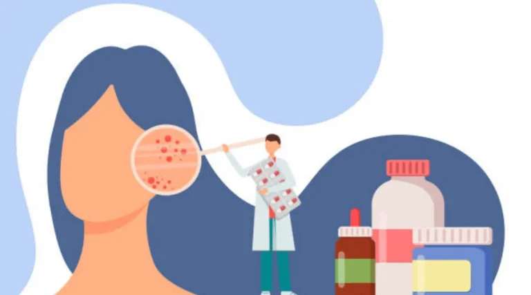 Où acheter de l’Isotrétinoïne 20 mg